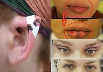 جراحی پلاستیک جراحی پلاستیک