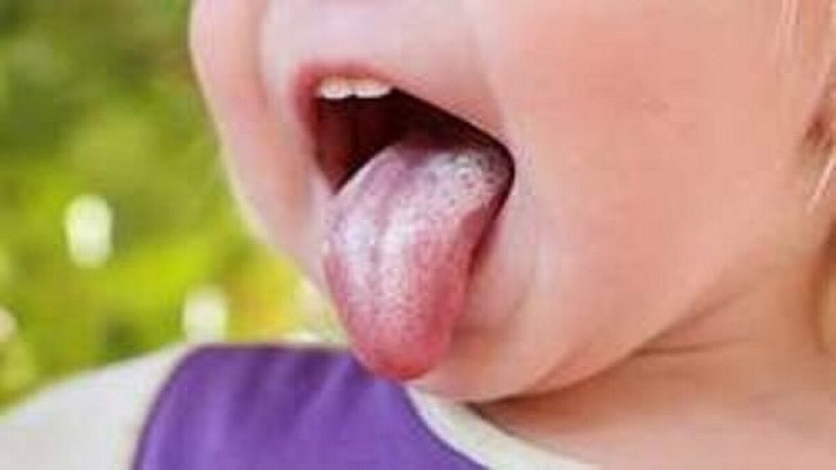 باشگاه خبرنگاران -حالت زبان انسان، نشانگر چه وضعیتی در سلامتی است؟