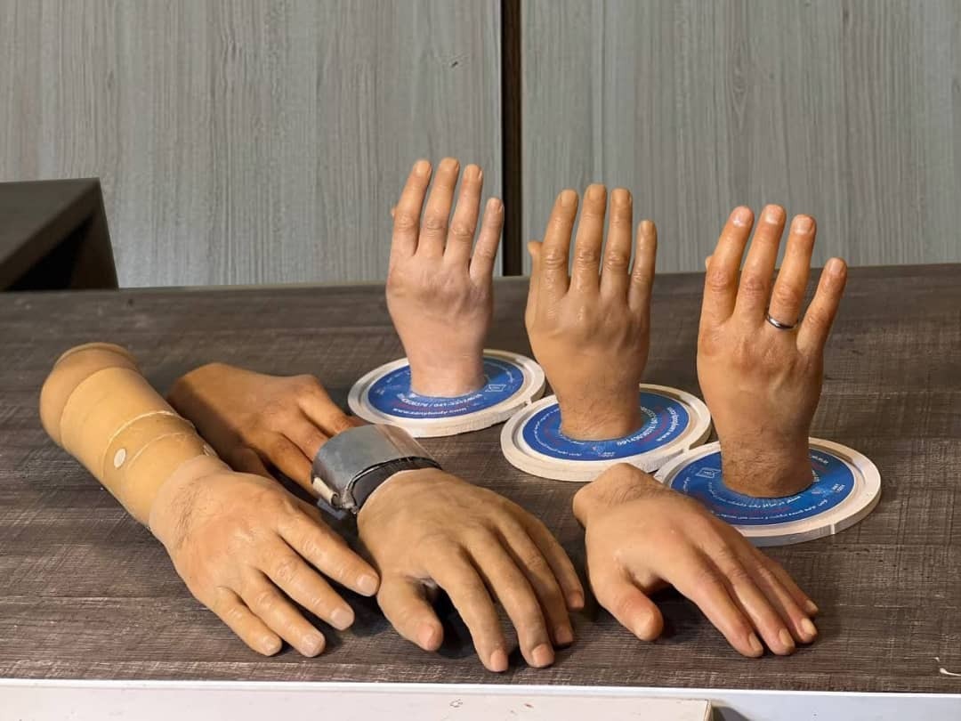 تولید دست مصنوعی مکانیکی توسط دانش بنیان ایرانی