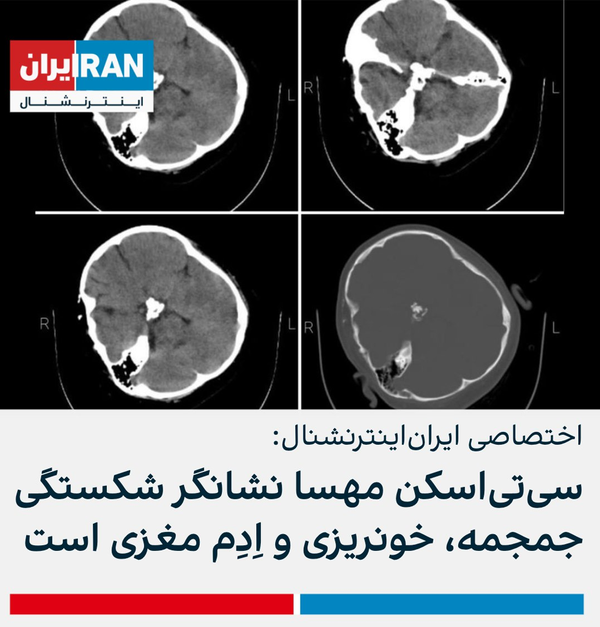 اسکن جعلی