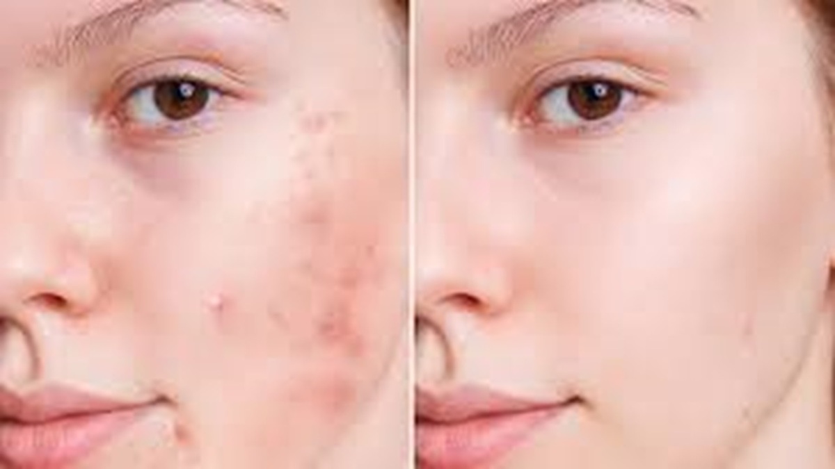 بارورهای غلط در ناباروری + فیلم