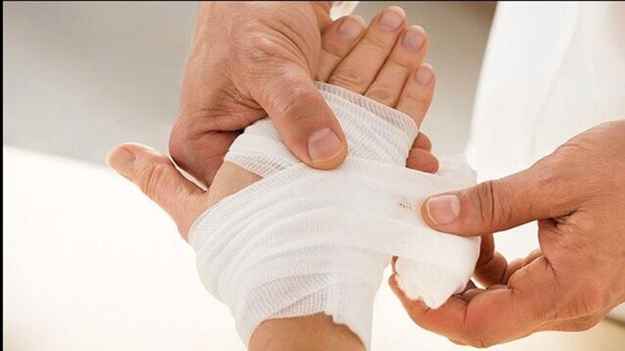تولید زخم‌پوش‌های دولایه برای ترمیم زخم‌های مزمن با قدرت کاهش خطر عفونت