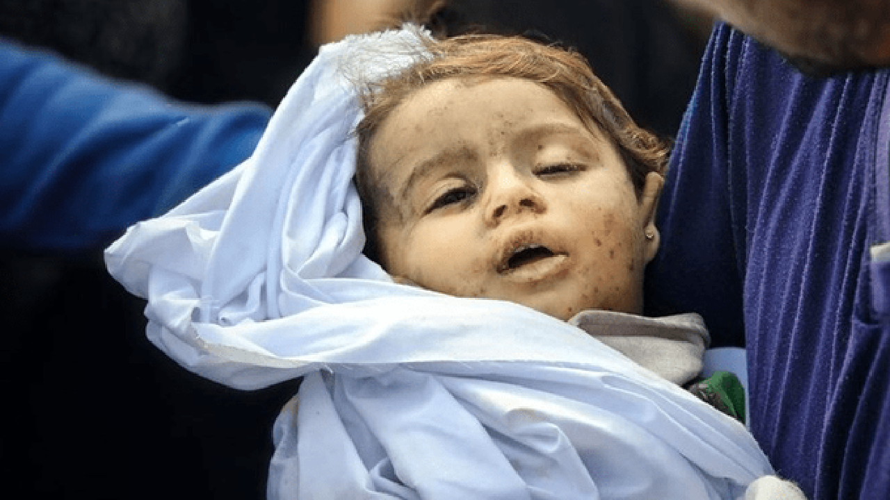 وزارت بهداشت: ۱۳۵۰ مصدوم زیر ۱۸ سال هستند