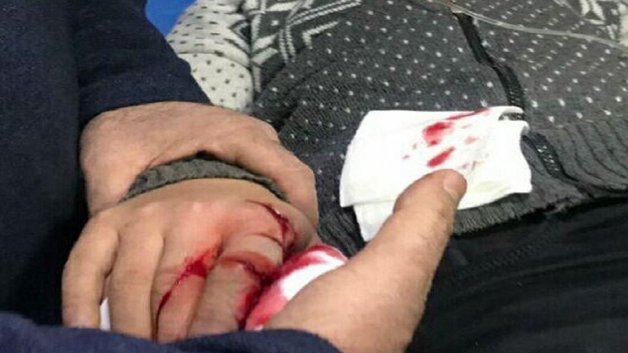 ۱۰۸ مصدوم در حوادث چهارشنبه آخر سال آذربایجان شرقی