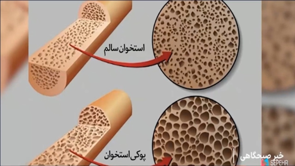 فناوری نانو در تولید ماسک‌های تنفسی + فیلم