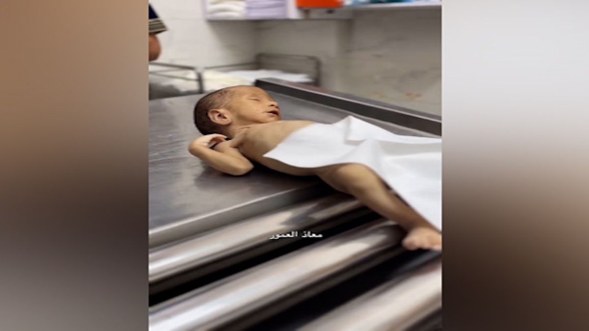 شهادت ۱۵ فلسطینی بر اثر گرسنگی تنها در یک روز + فیلم