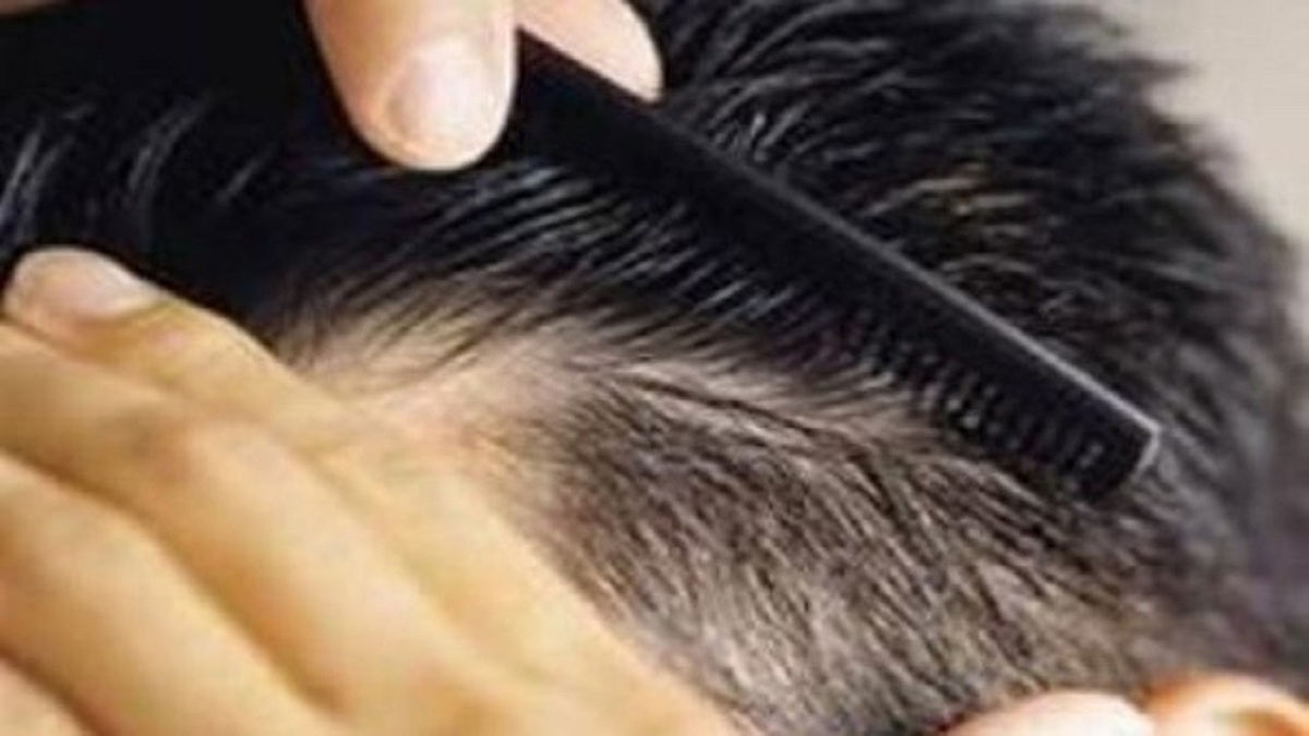باشگاه خبرنگاران -راهکار‌های طب ایرانی برای تقویت مو