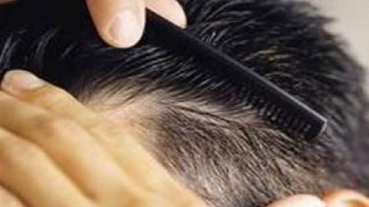 راهکار‌های طب ایرانی برای تقویت مو