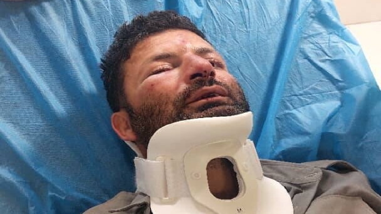 دومین حمله به حافظان طبیعت در شمیرانات؛ این بار ضرب و شتم یک محیط‌بان