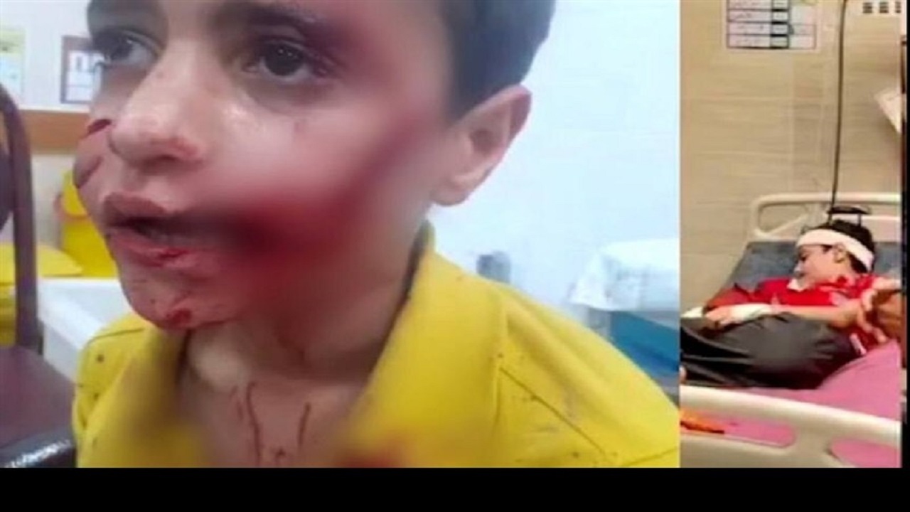 کودک ۱۱ ساله قربانی حمله ‌سگ‌های ولگرد شد/‌ امیرعلی  جان باخت