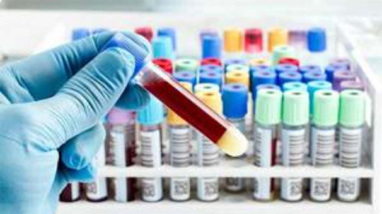 انجام نزدیک به ۱۴۵ هزار انواع آزمایش تشخیص بیماریهای دام‌ و طیور در آذربایجان غربی