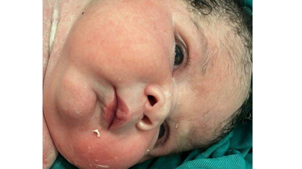 تولد نوزاد ۶ کیلو و ۱۰۰ گرمی در بیمارستان کوثر سنندج