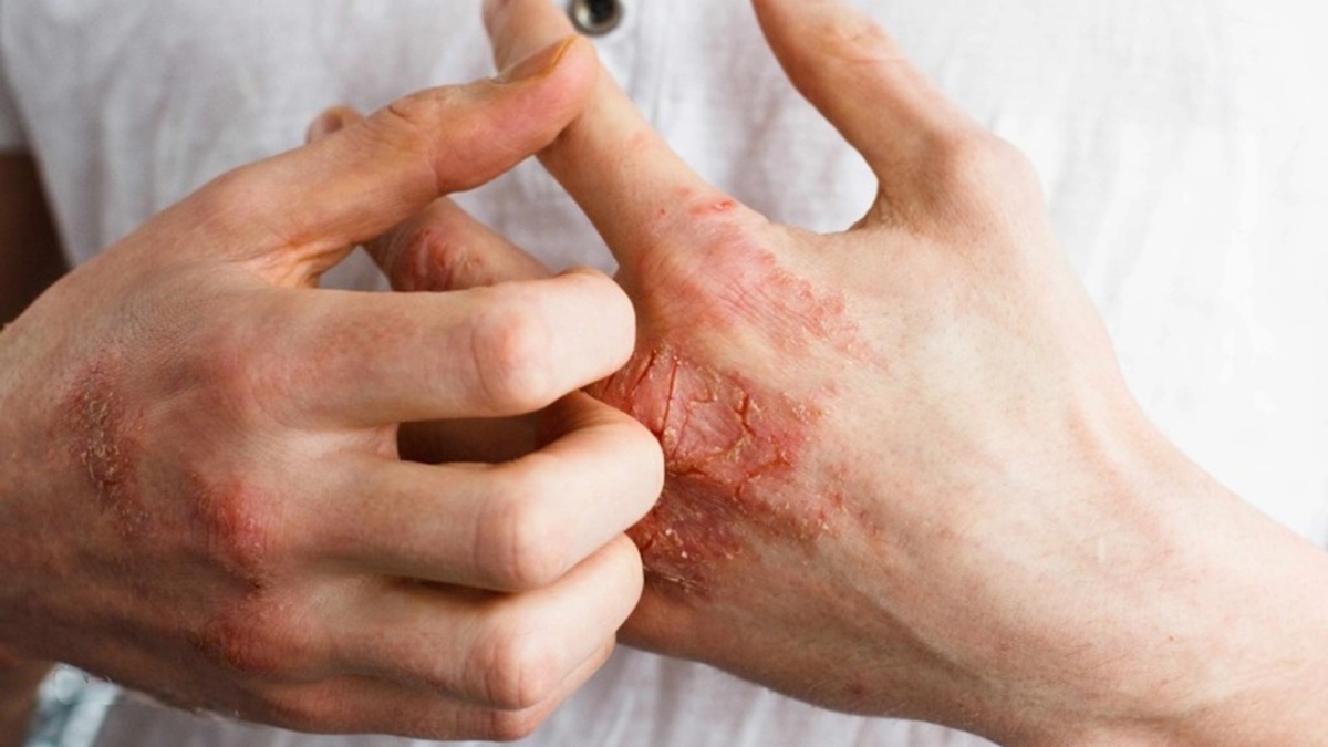 سیگار چگونه باعث ابتلا به سرطان می‌شود؟ + فیلم