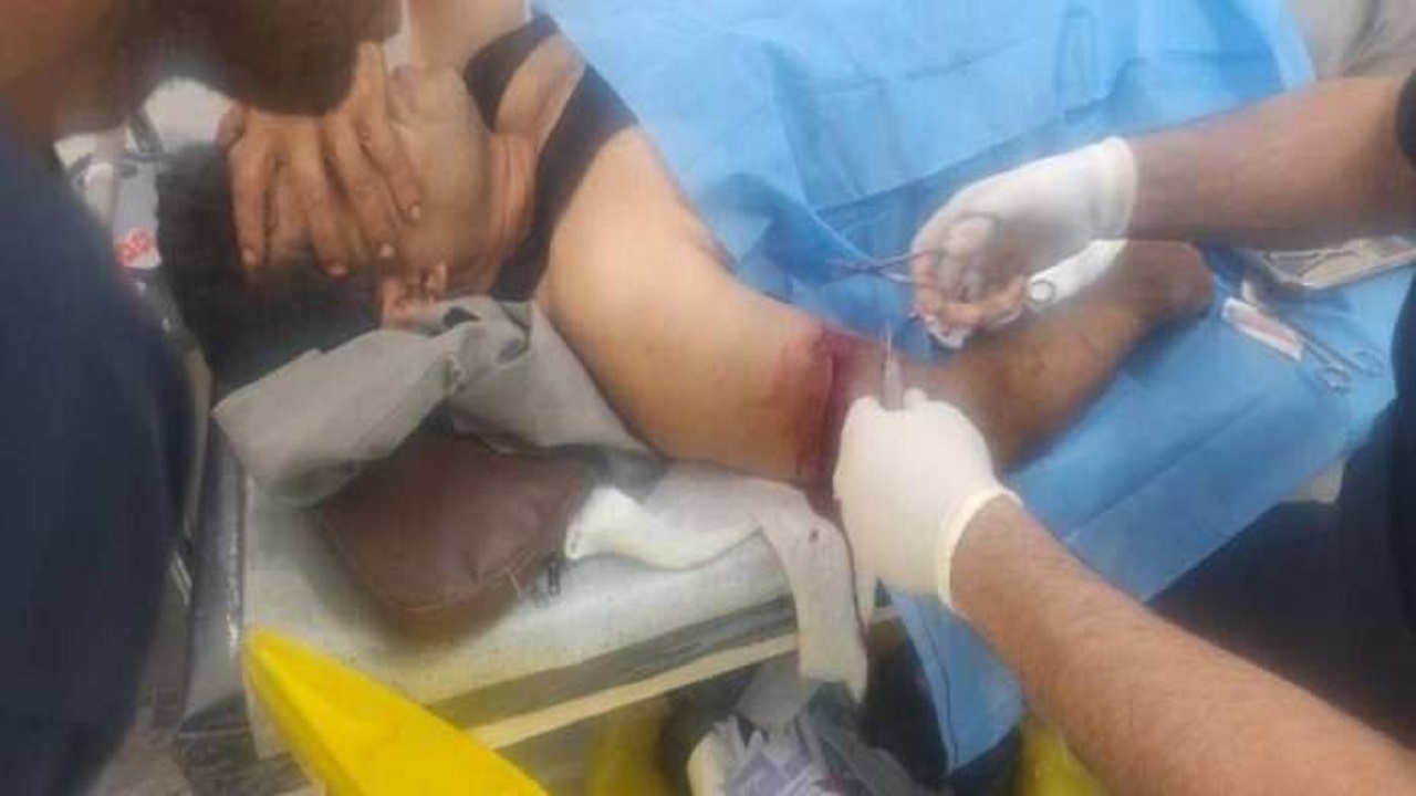ضارب محیط‌بان پارک ملی دز دستگیر شد