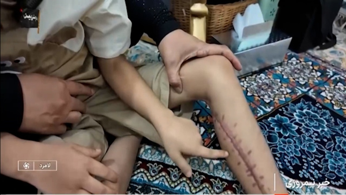 کودکانی که قد نکشیده جانباز شدند + فیلم