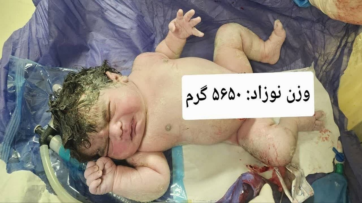 باشگاه خبرنگاران -تولد نوزاد ۵ کیلو و ۶۵۰ گرمی در بیمارستان امام رضا (ع) کرمانشاه