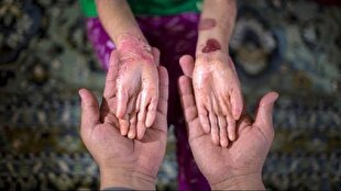 محموله نفت آمریکایی با حکم دادگاه به نفع بیماران پروانه‌ای به فروش رفت