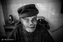 جذام، طعم تلخ زندگی