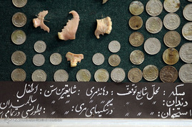 اجسام خارج شده از بدن بیماران در مراکز درمانی-مشهد

