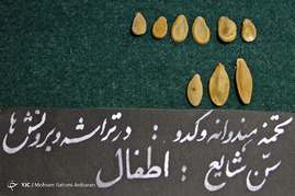اجسام خارج شده از بدن بیماران در مراکز درمانی-مشهد
