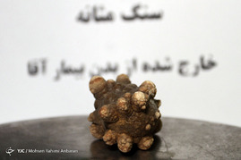 اجسام خارج شده از بدن بیماران در مراکز درمانی-مشهد
