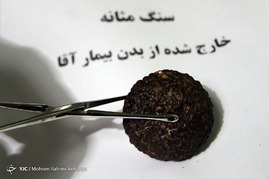 اجسام خارج شده از بدن بیماران در مراکز درمانی-مشهد
