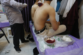زالو درمانی و طب سنتی