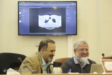 رونمایی از سامانه تشخیص پونومی COVID ۱۹